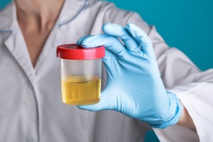 Quel est le lien entre le microbiote urinaire et l’incontinence ?